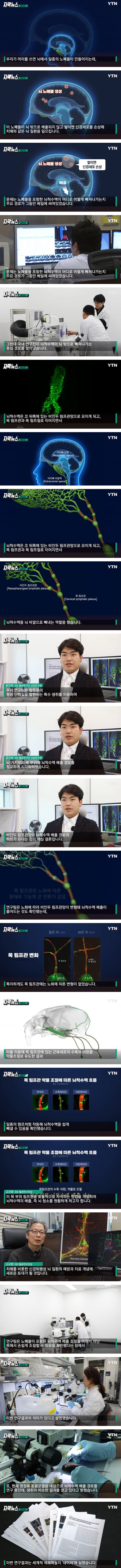 [이슈/유머]치매 돌파구 마련한 국내 연구진