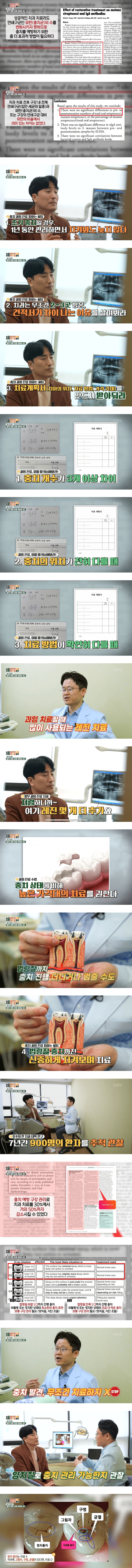 [이슈/유머]치과 과잉 치료 피하는 법